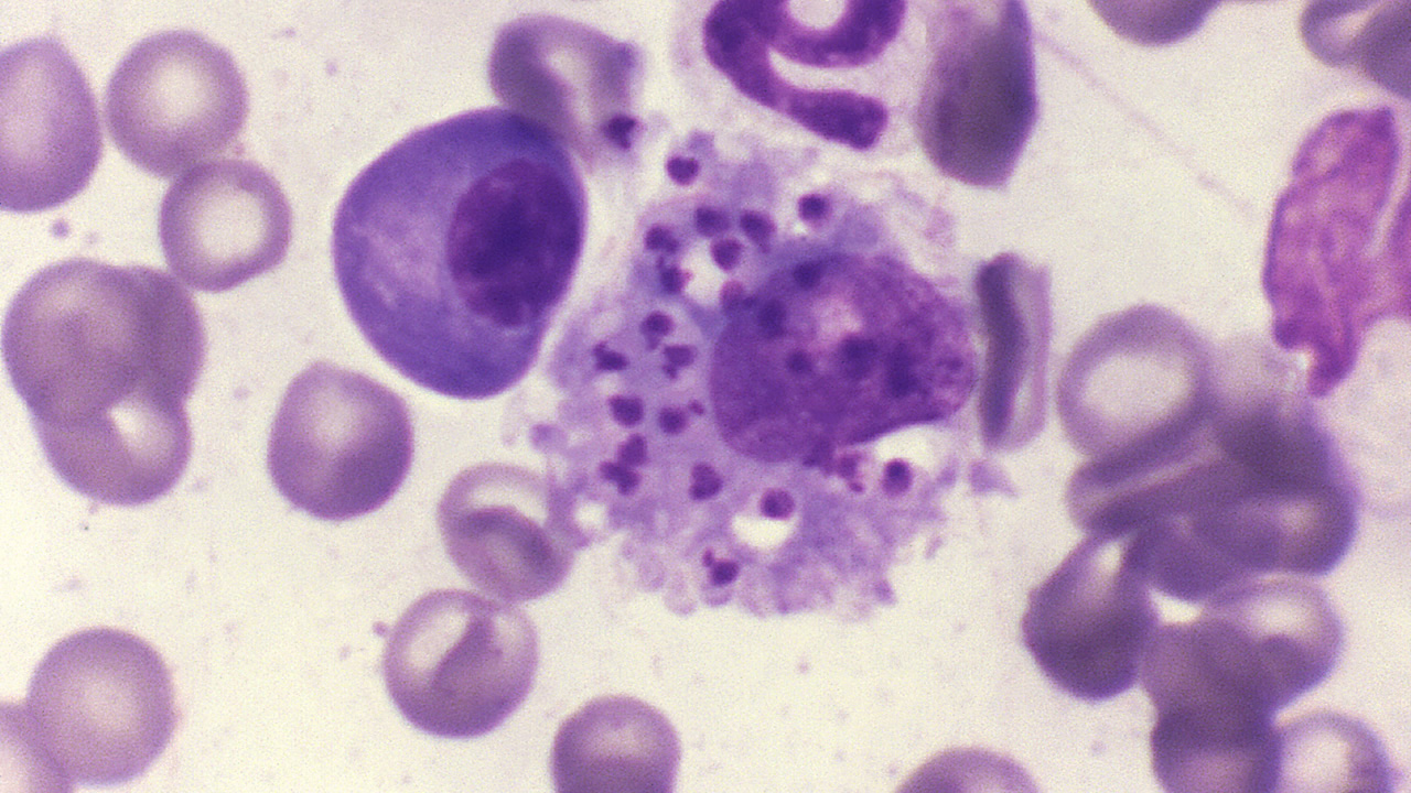 Afinal, o que é Leishmaniose Visceral Canina?